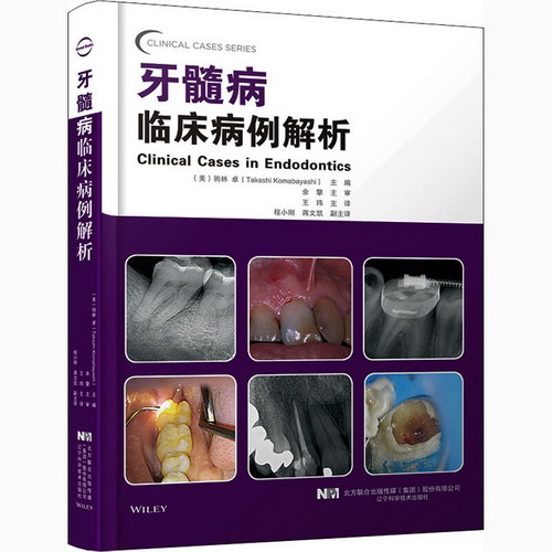 牙髓病臨床病例解析 圖書