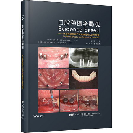 口腔種植全局觀——全身疾病患者口腔種植的循證醫學指南 圖書