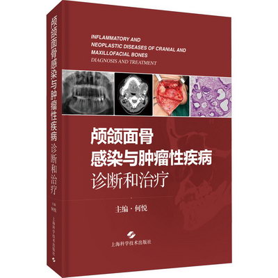 顱頜面骨感染與腫瘤性疾病 診斷和治療 圖書