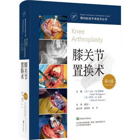 膝關節置換術(第4版)(精)/骨科標準手術技術叢書 圖書