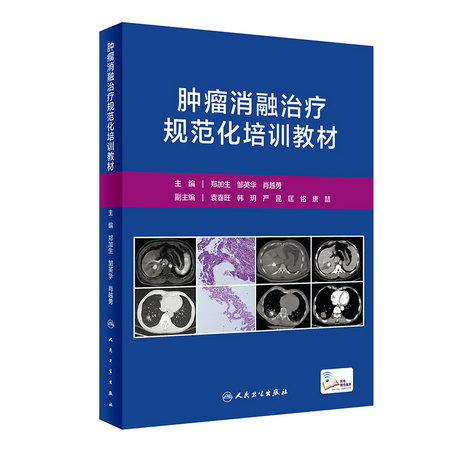腫瘤消融治療規範化培訓教材（配增值） 圖書