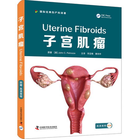 子宮肌瘤 圖書
