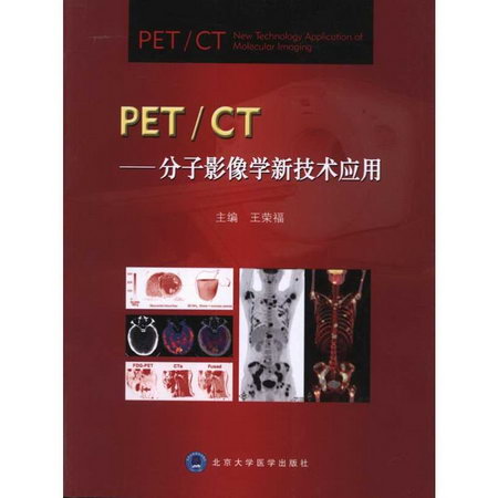 PET/CT:分子影像學新技術應用