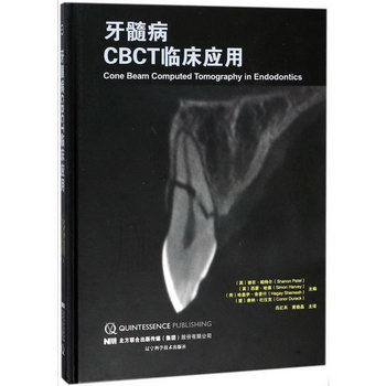 牙髓病CBCT臨床應