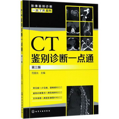 CT鋻別診斷一點通(第3版)