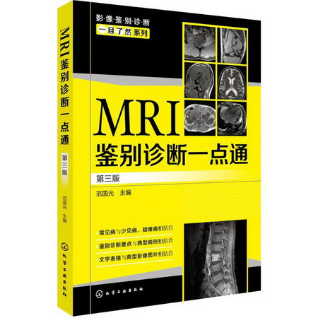 MRI鋻別診斷一點通(第3版)